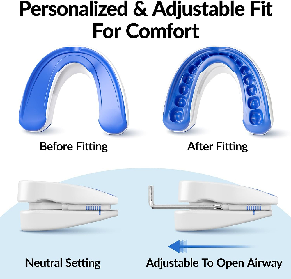 Before and after fitting of a blue dental device with adjustable features on a white background.