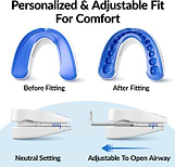 vitalsleep device opens airway to reduce snoring