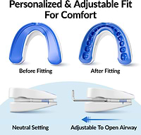 vitalsleep device opens airway to reduce snoring