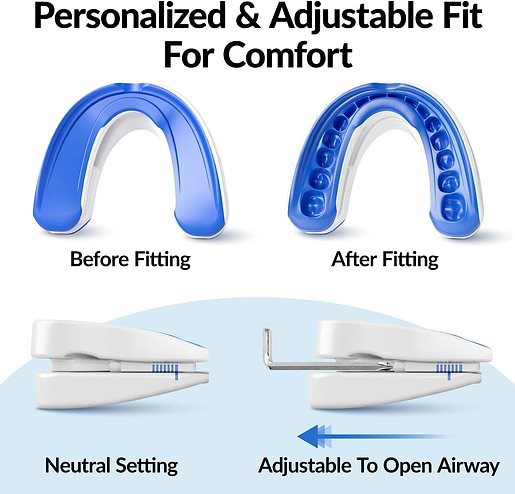 vitalsleep device opens airway to reduce snoring