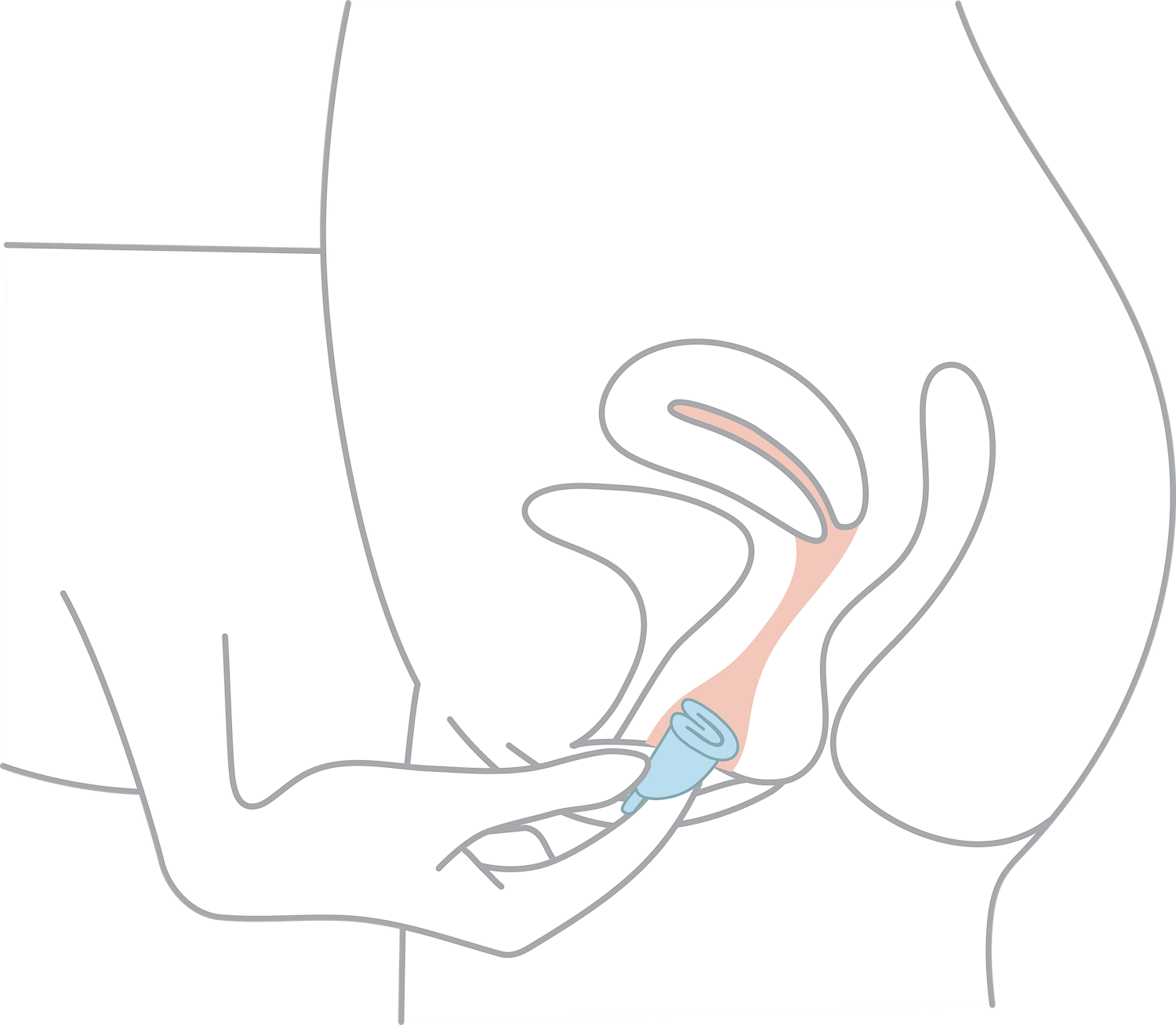 Insert One - Instructions 