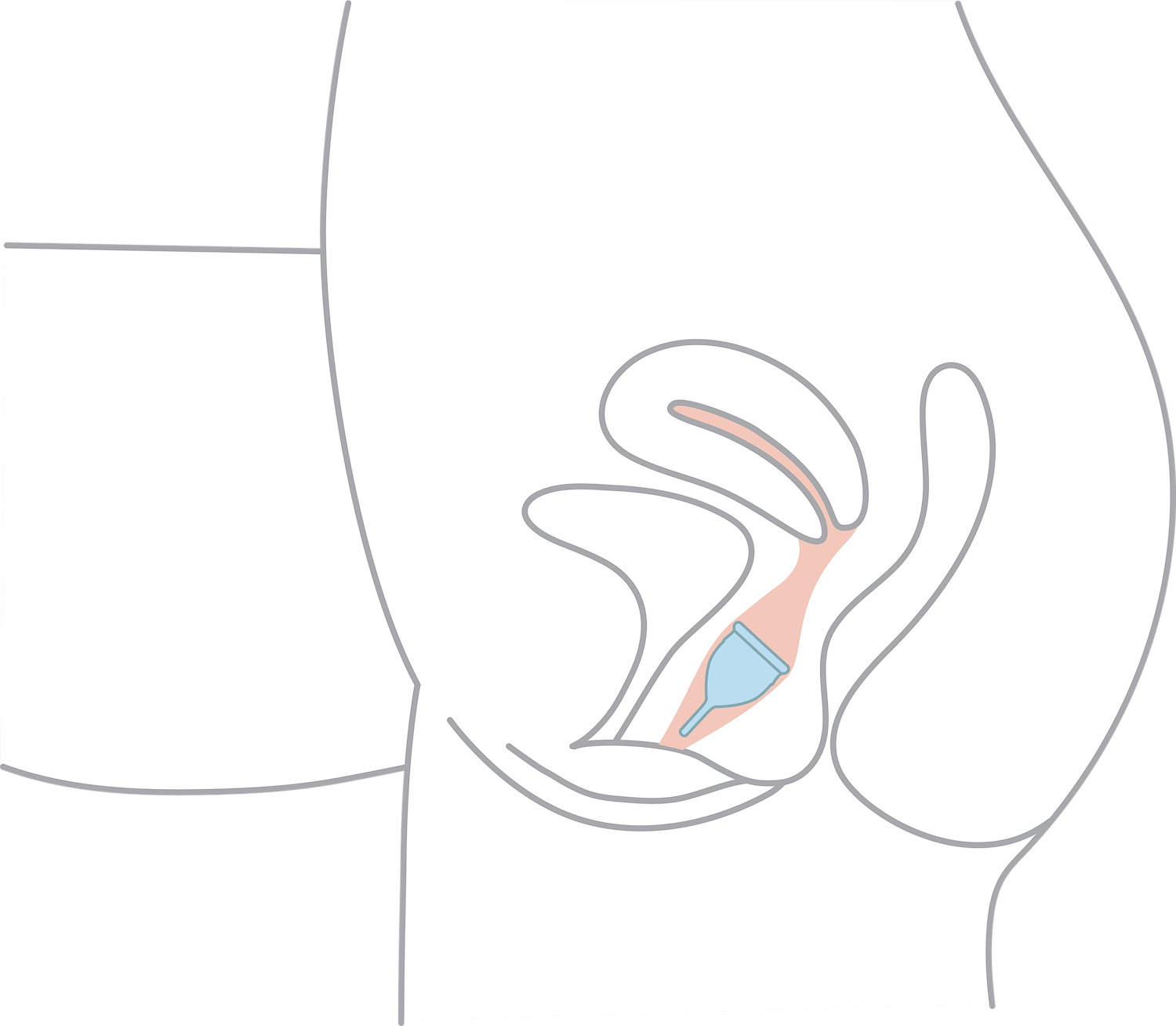 Insert Two - Instructions