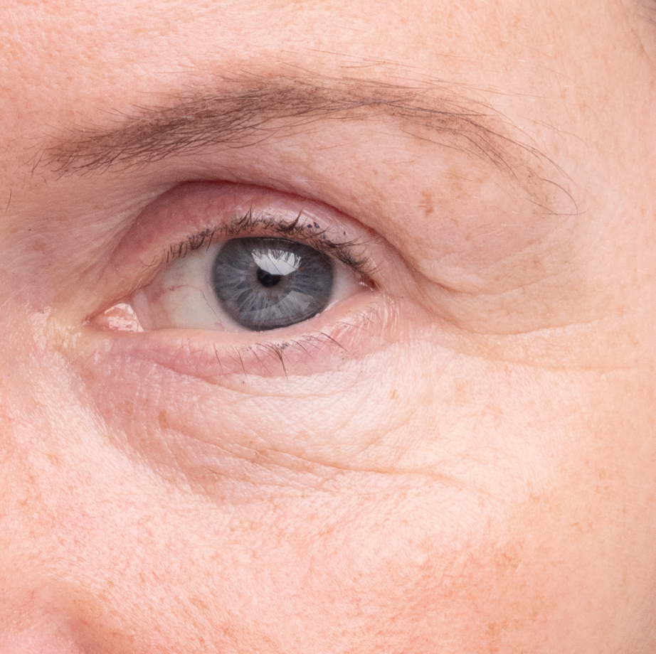 after use of madara age pro line -  Results achieved using the complete Age Pro range together