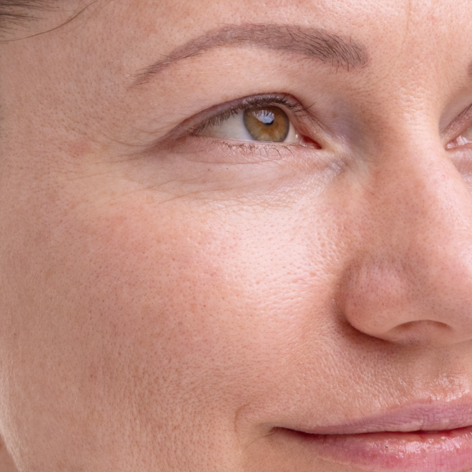 close-up of womans face after using Madara Kojic Alternative Pigment Serum