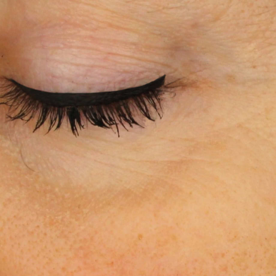 close-up of womans facial skin after using Madara retinol alternative Plant-Powered Serum
