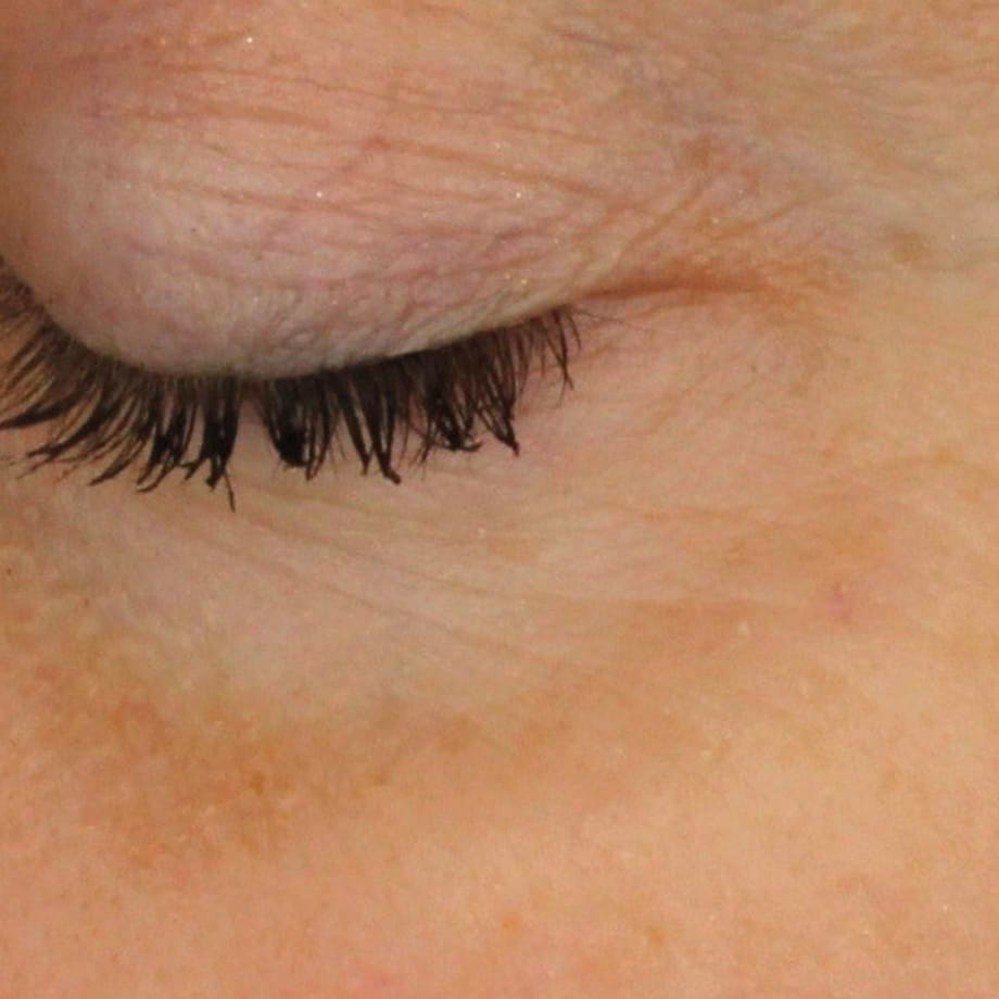 close-up of womans facial skin before using Madara retinol alternative Plant-Powered Serum