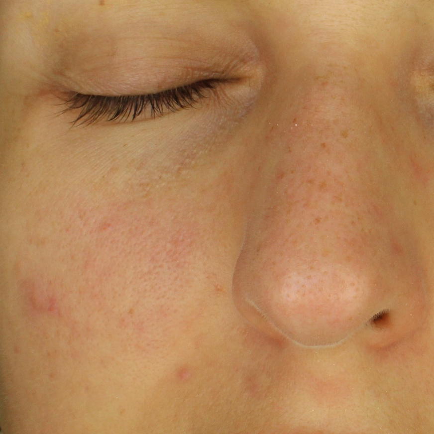facial skin before madara niacinamide serum
