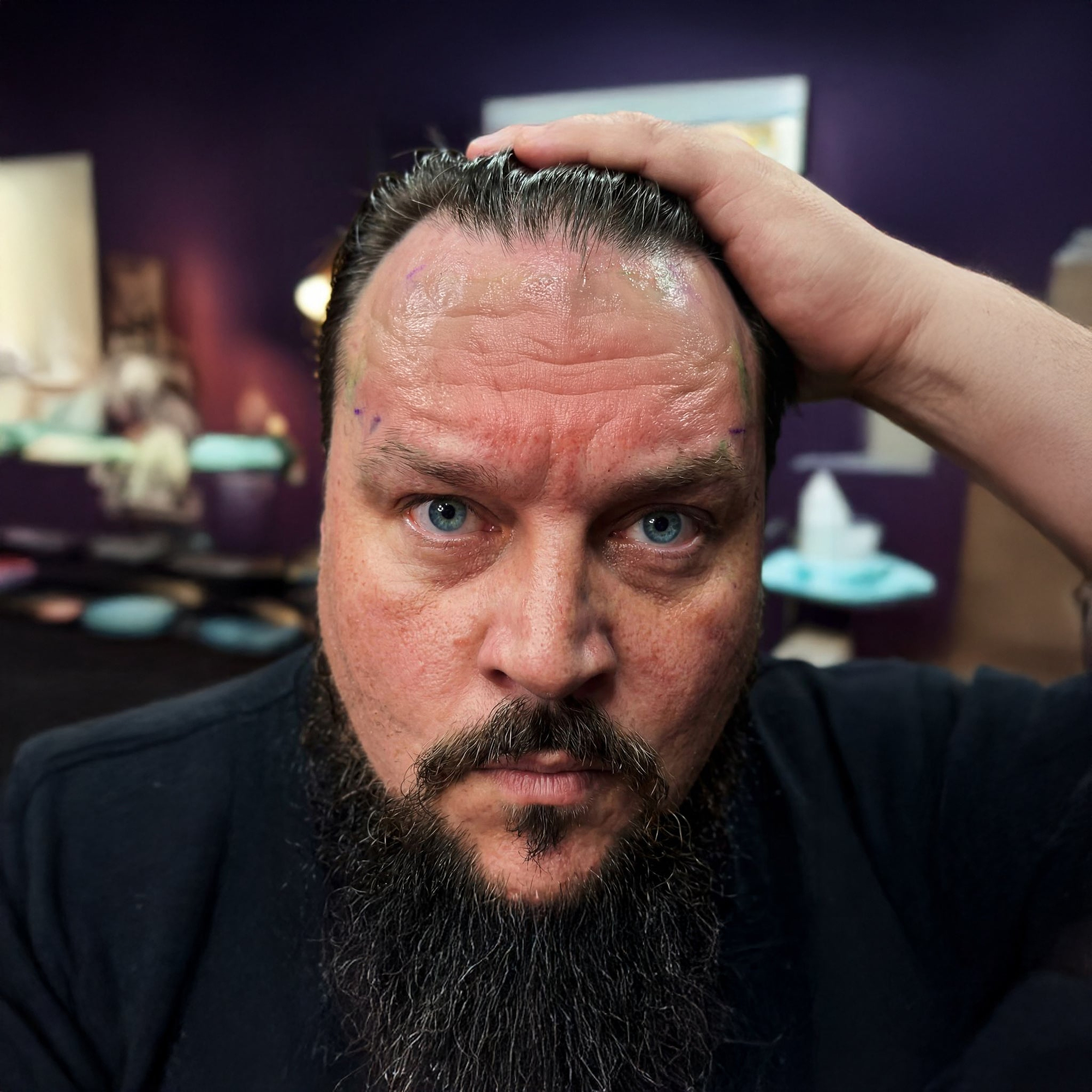 Charlie Sloth showing his forehead with tattoo removed