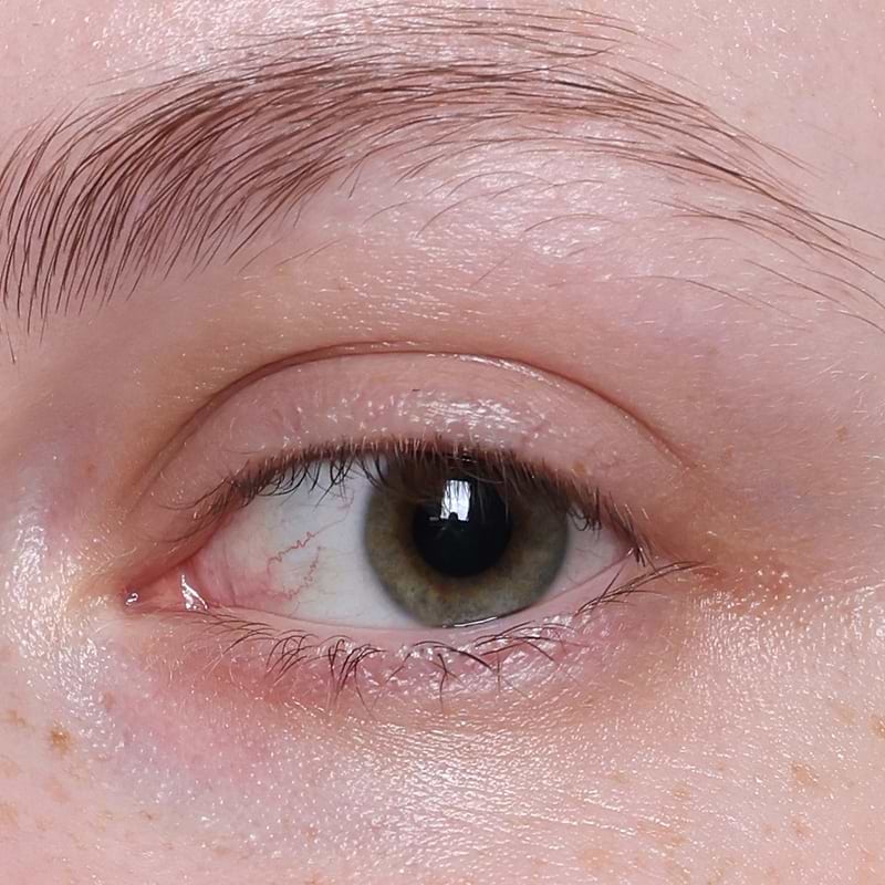 After Application Image