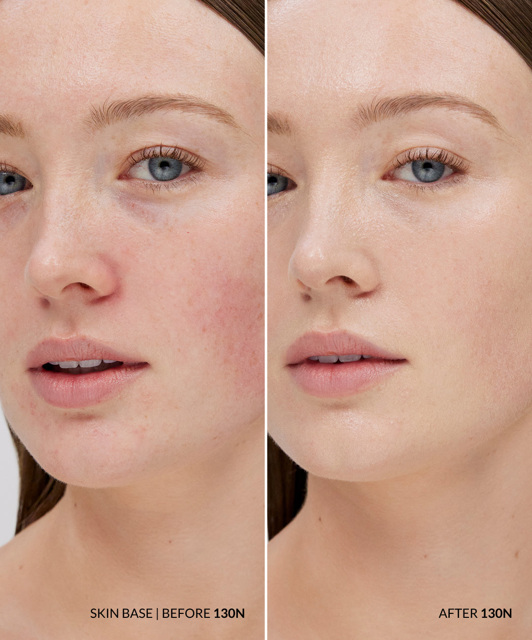 The Skin Base Set