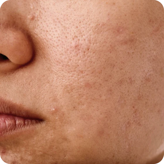 Dull Skin
