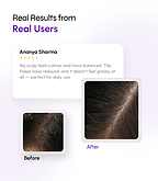 Multi-Action Serum for Flake-Free & Balanced Scalp