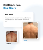 Acne Clarifying Body Mist