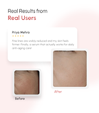 Advanced Age Correction Serum with Botanicals & Biomimetic Peptides