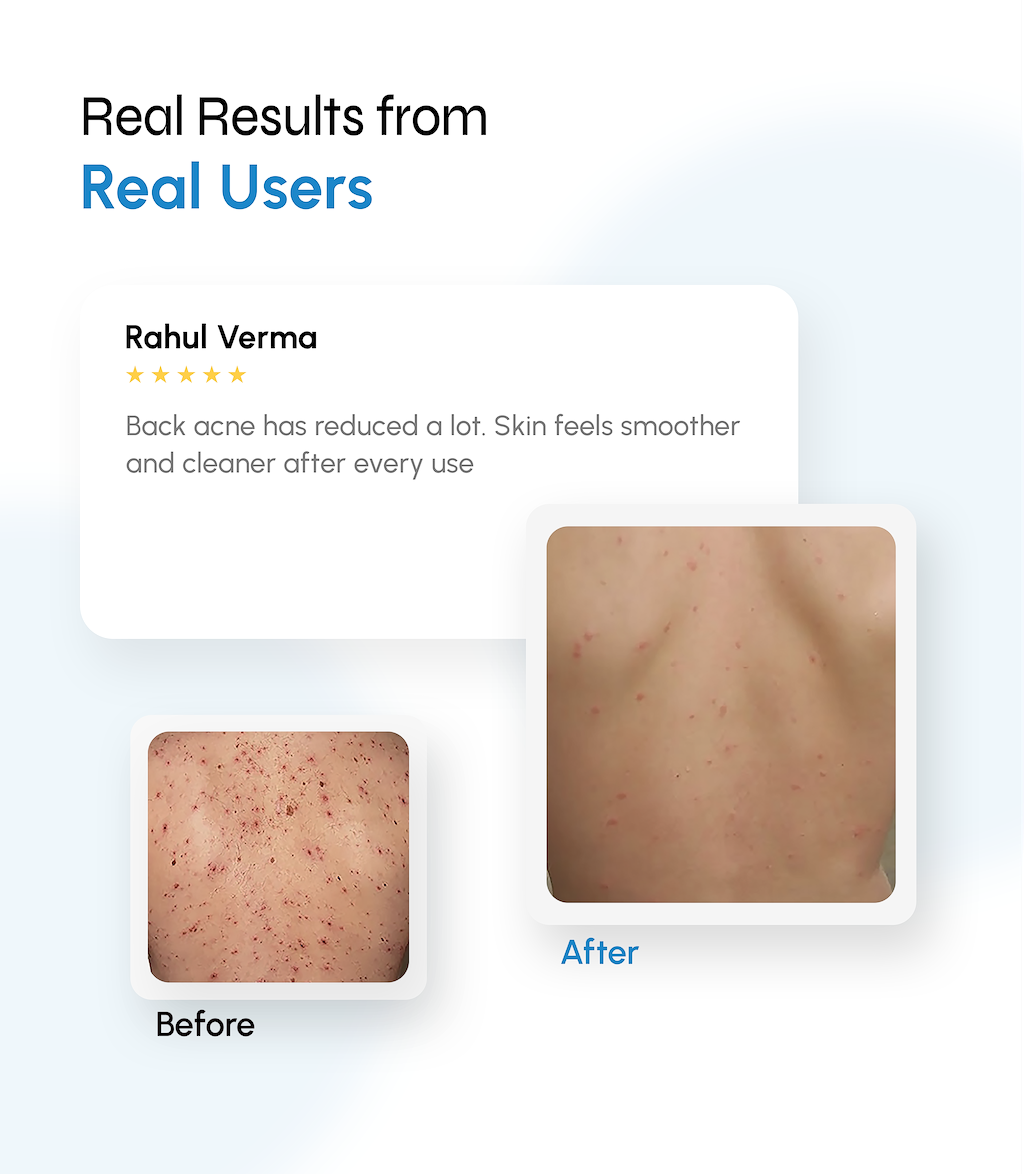 Microclear Exfoliating Bodywash