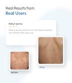 Microclear Exfoliating Bodywash