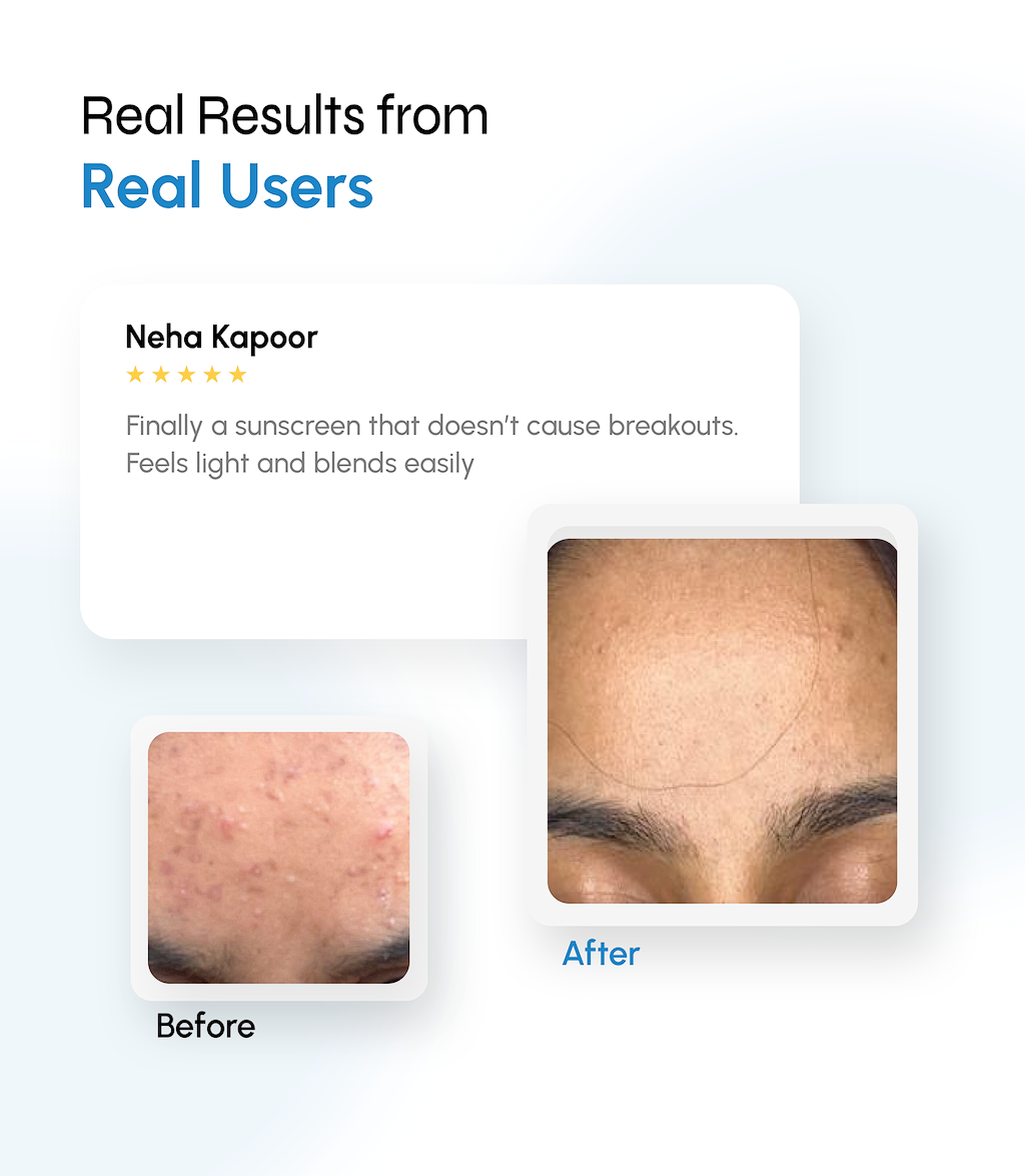 Breakout-Control Sunscreen with Broad Spectrum Shield