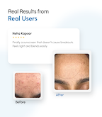 Breakout-Control Sunscreen with Broad Spectrum Shield