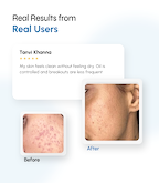 Acne Control & Purifying Cleanser