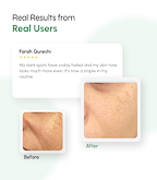 Depigmentation & Spot Correction Serum