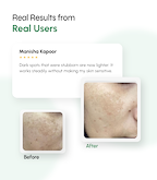 Dark Spot Defense Sunscreen with Tone-Perfecting Actives