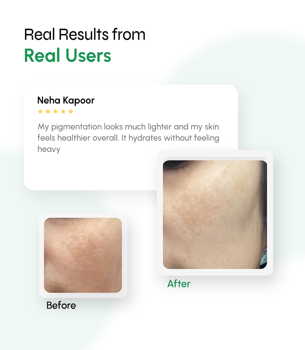 Bio Engineered Pigment Control Complex Cream