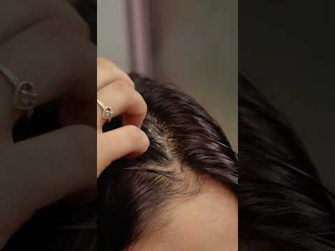 Multi-Action Serum for Flake-Free & Balanced Scalp
