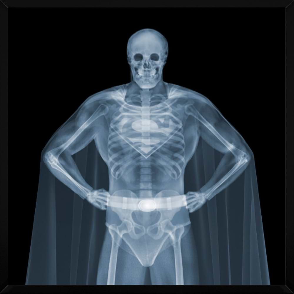 Superman (Framed)
