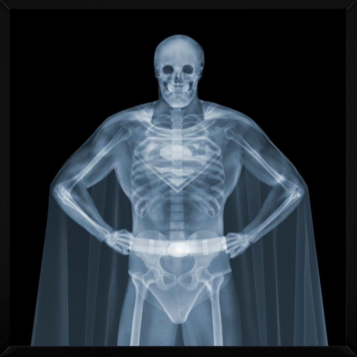 Superman (Framed)