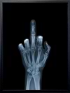 The Finger (Framed)