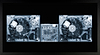 Decks (Framed)