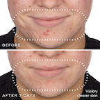 Niacinamide Peptides