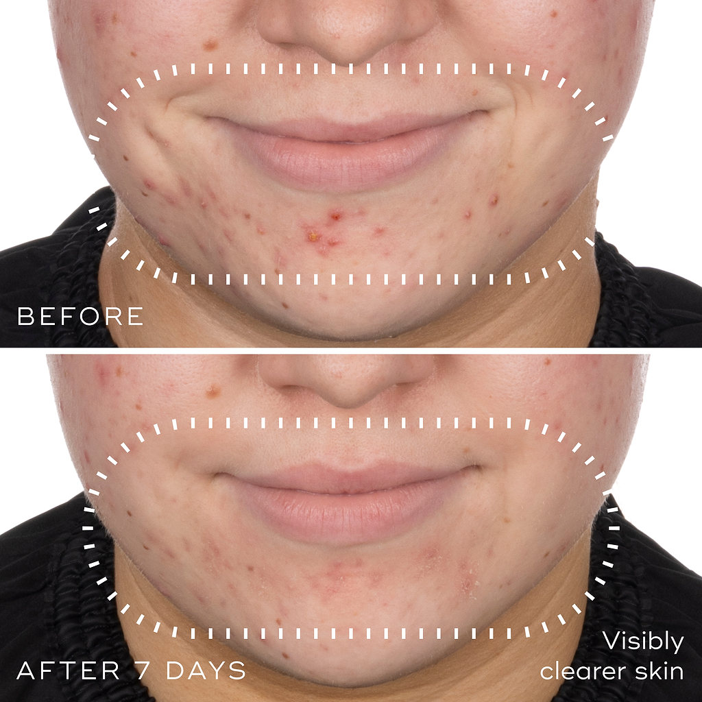 Niacinamide Peptides