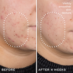 Niacinamide Peptides