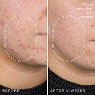 Niacinamide Peptides