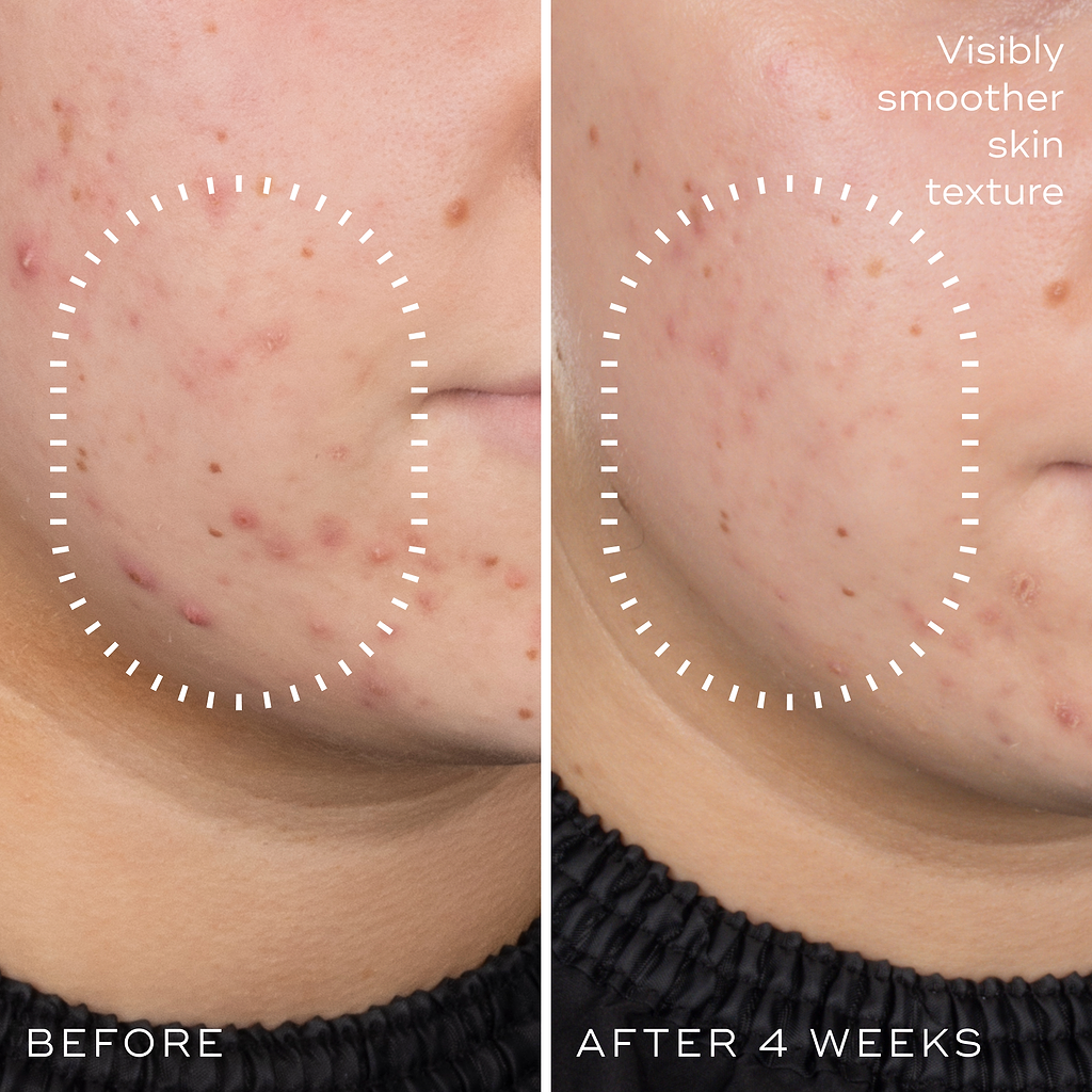 Niacinamide Peptides