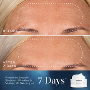 Advanced Night Ceramide