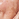 Dark Spots