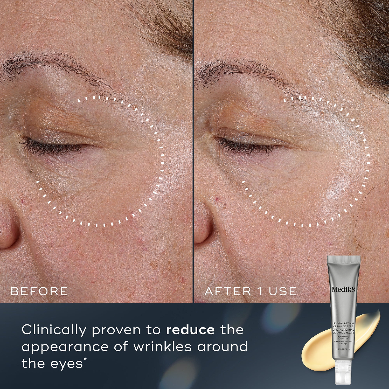 Crystal Retinal® Ceramide Eye