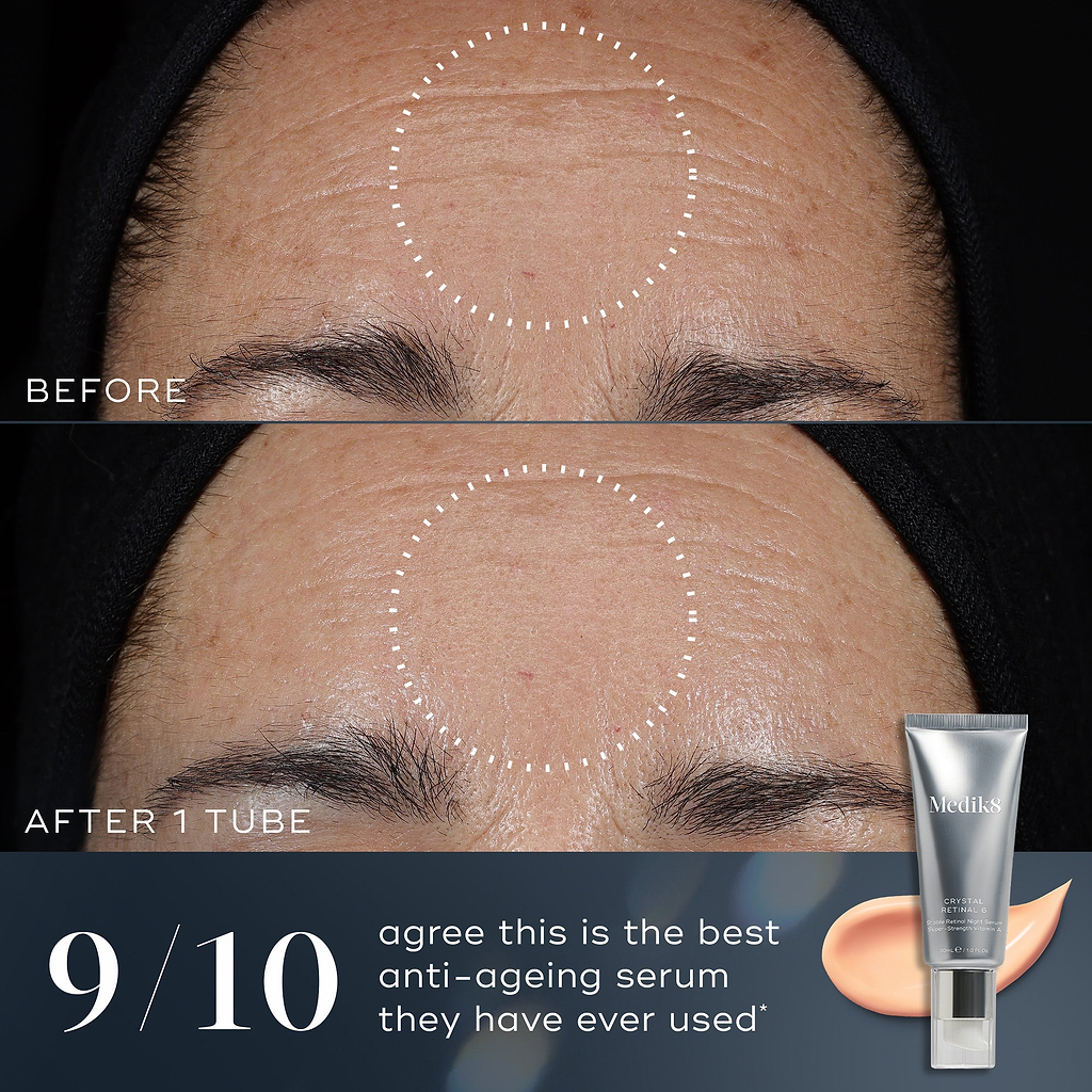 A before-and-after comparison of a person's forehead shows visible improvement in fine lines and wrinkles after one tube of Crystal Retinal. Text states 9/10 agree this is the best anti-ageing serum they have ever used.