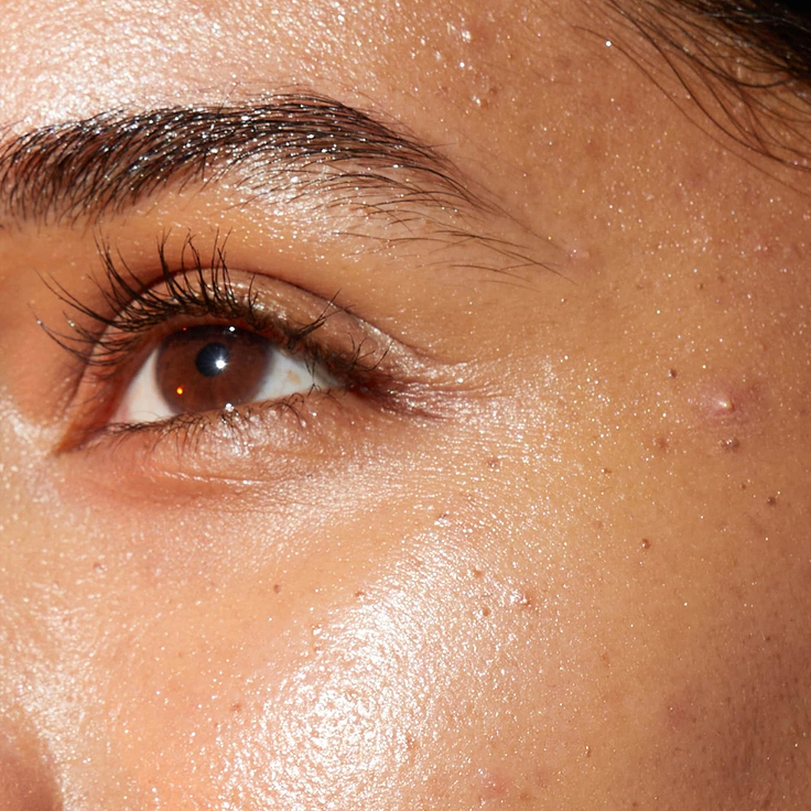 A detailed close-up photograph illustrating visible blemishes and texture associated with enlarged pores around a person's eye and cheek. Below the image, clear text identifies this skin concern as 'Blemish & Enlarged Pores'.