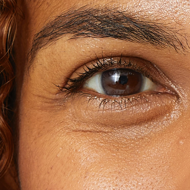 A detailed close-up photograph illustrating visible fine lines and wrinkles around a person's eye. Below the image, clear text identifies this skin concern as 'Fine Lines & Wrinkles'
