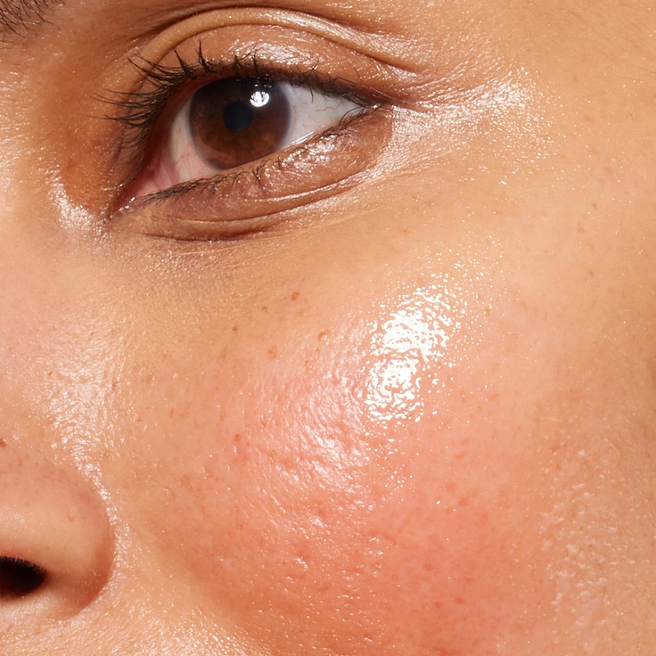 A detailed, close-up photograph illustrating visible redness and texture on a person's cheek. Below the image, clear text identifies this skin concern as 'Redness'.