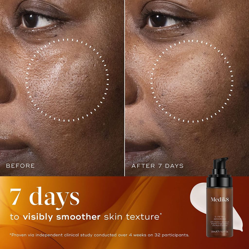 Before and after close-up of a participant’s skin over 7 days, demonstrating visibly smoother skin texture and refined appearance.