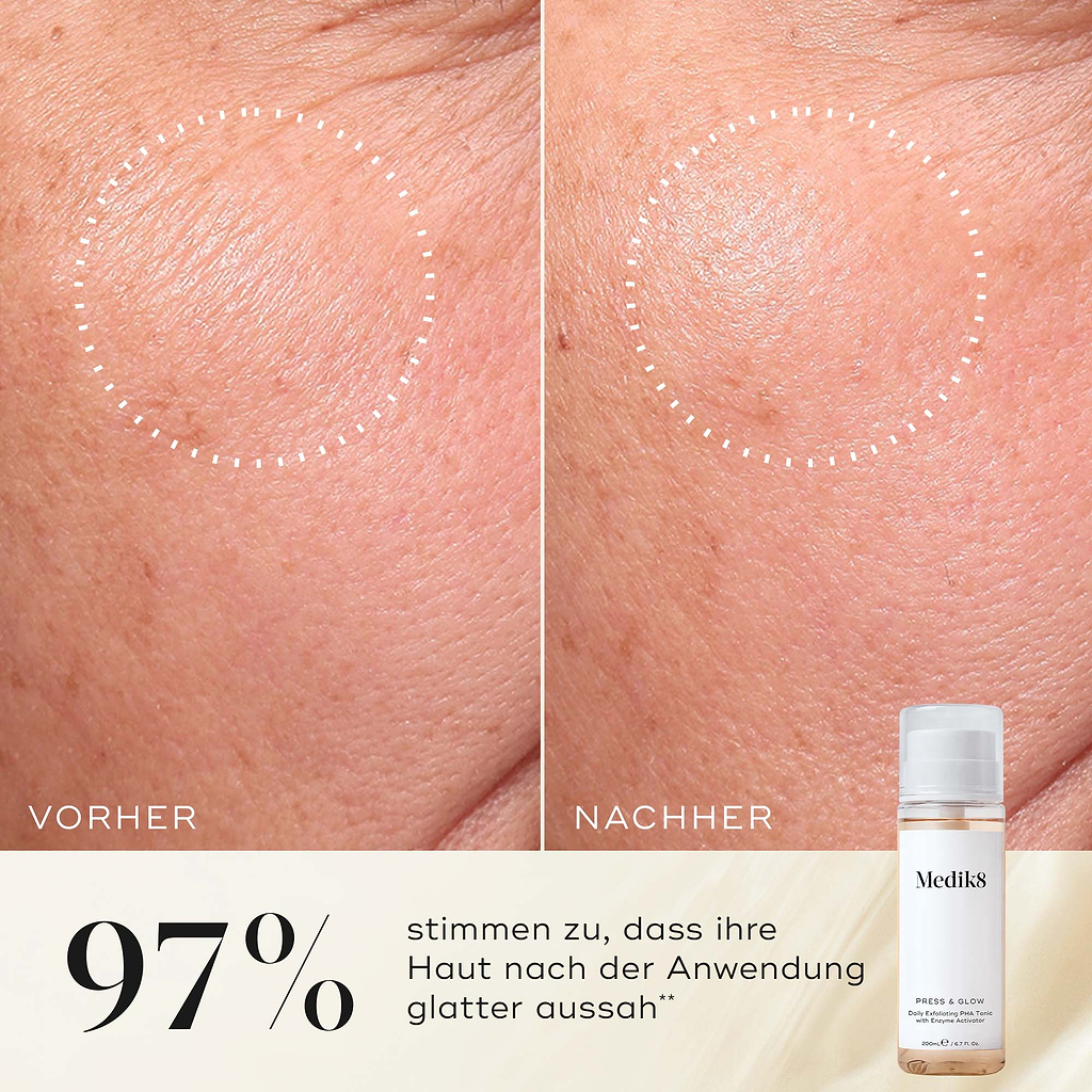 Nahaufnahme der Wange einer Teilnehmerin vor und nach der Anwendung, die eine glattere Textur und ein gleichmäßigeres Erscheinungsbild zeigt. Die Medik8 Press & Glow-Tonikflasche ist in der Ecke zu sehen. Der Text hebt hervor: „97 % stimmen zu, dass ihre Haut nach der Anwendung glatter aussah.“