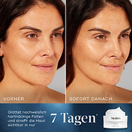 Nebeneinander Vergleich des Gesichts einer Frau, gekennzeichnet als Vorher und Sofort Danach, mit sichtbar gesteigerter Ausstrahlung und Feuchtigkeit. Der Text unten lautet Nachweislich glättet es hartnäckige Falten und hebt die Haut sichtbar in nur 7 Tagen.