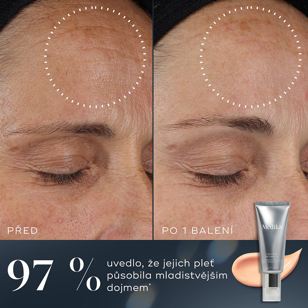 97 % – Srovnání „před a po“ na čele účastníka ukazuje viditelně zlepšenou pleť po jednom balení Medik8 Crystal Retinal. Text uvádí, že 97 % lidí mělo pocit, že jejich pleť vypadá mladistvěji.