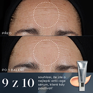 9/10 – Srovnání „před a po“ na čele osoby ukazuje viditelné zlepšení jemných linek a vrásek po jednom balení Crystal Retinal. Text uvádí, že 9 z 10 souhlasí, že jde o nejlepší anti-ageing sérum, které kdy použili.