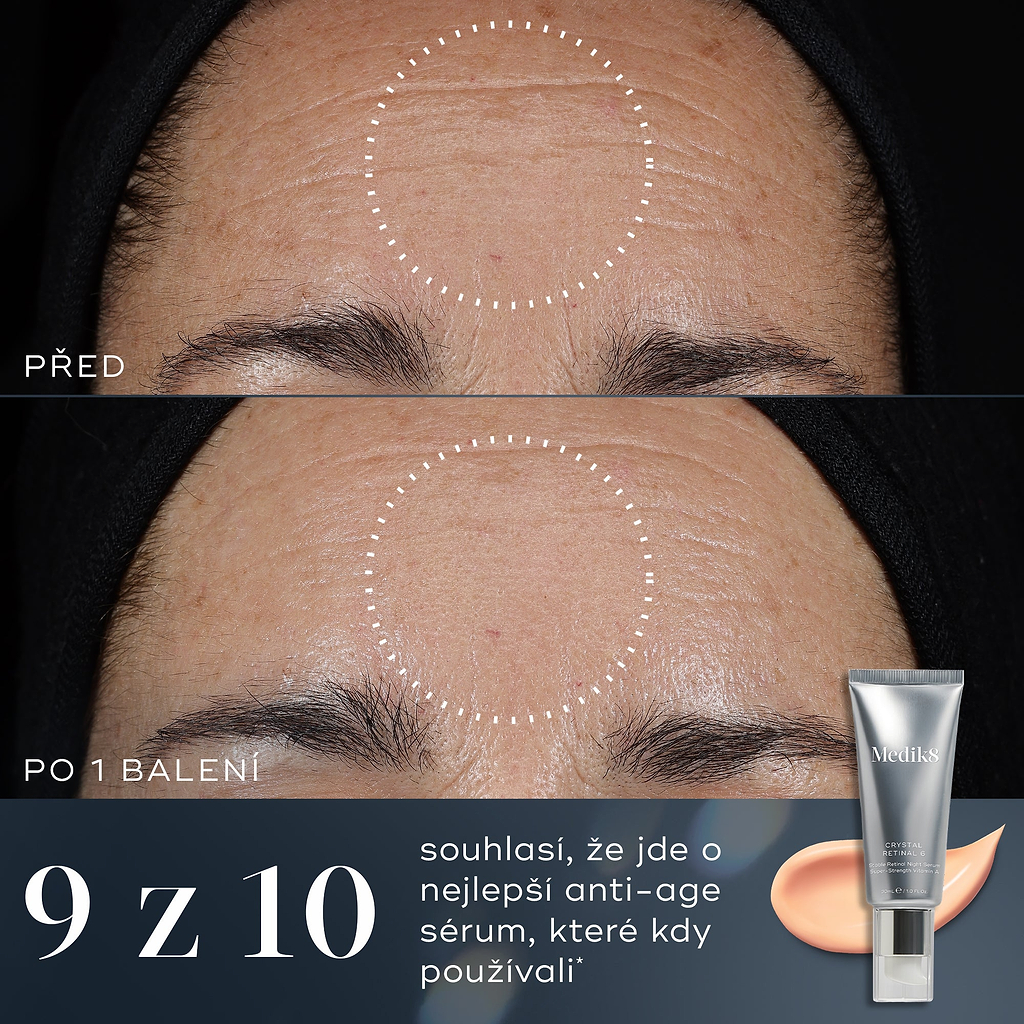 9/10 – Srovnání „před a po“ na čele osoby ukazuje viditelné zlepšení jemných linek a vrásek po jednom balení Crystal Retinal. Text uvádí, že 9 z 10 souhlasí, že jde o nejlepší anti-ageing sérum, které kdy použili.