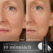 10 minuty – Srovnání „před a po“ obličeje účastníka zobrazené vedle lahvičky Medik8 Liquid Peptides Advanced MP ukazuje snížení vrásek v oblasti očí a úst. Text zdůrazňuje, že 100 % účastníků vykázalo klinické zlepšení viditelných vrásek během 10 minut.